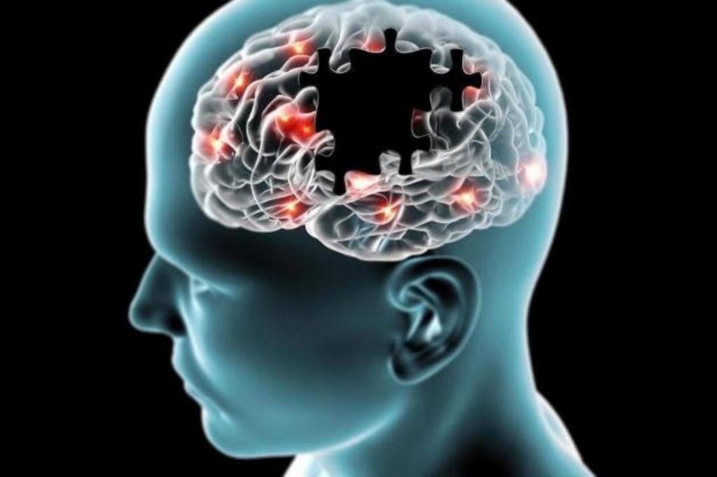 Як розпізнати головний вечірній симптом деменції, який загострюється восени Деменція