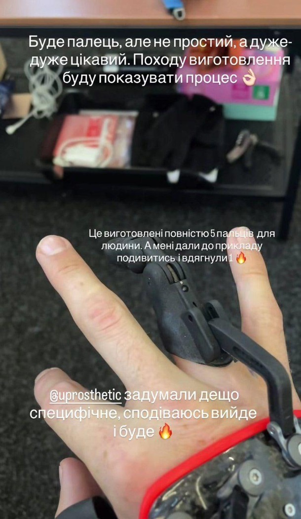 Артур Логай після втрати пальця приміряв протез