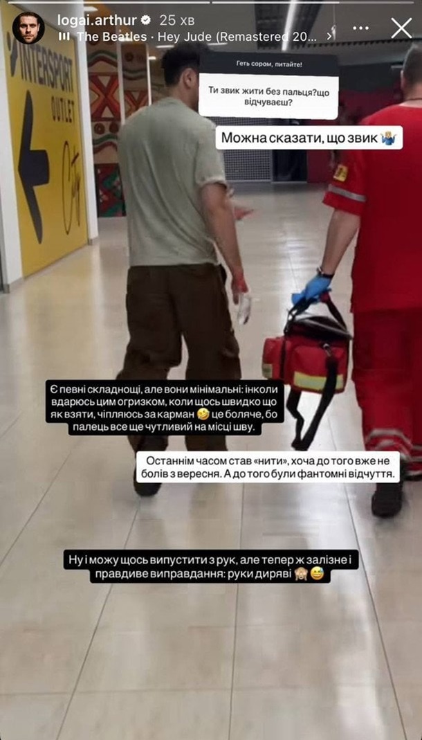Артур Логай після втрати пальця: як актор звик до змін і жартує попри біль