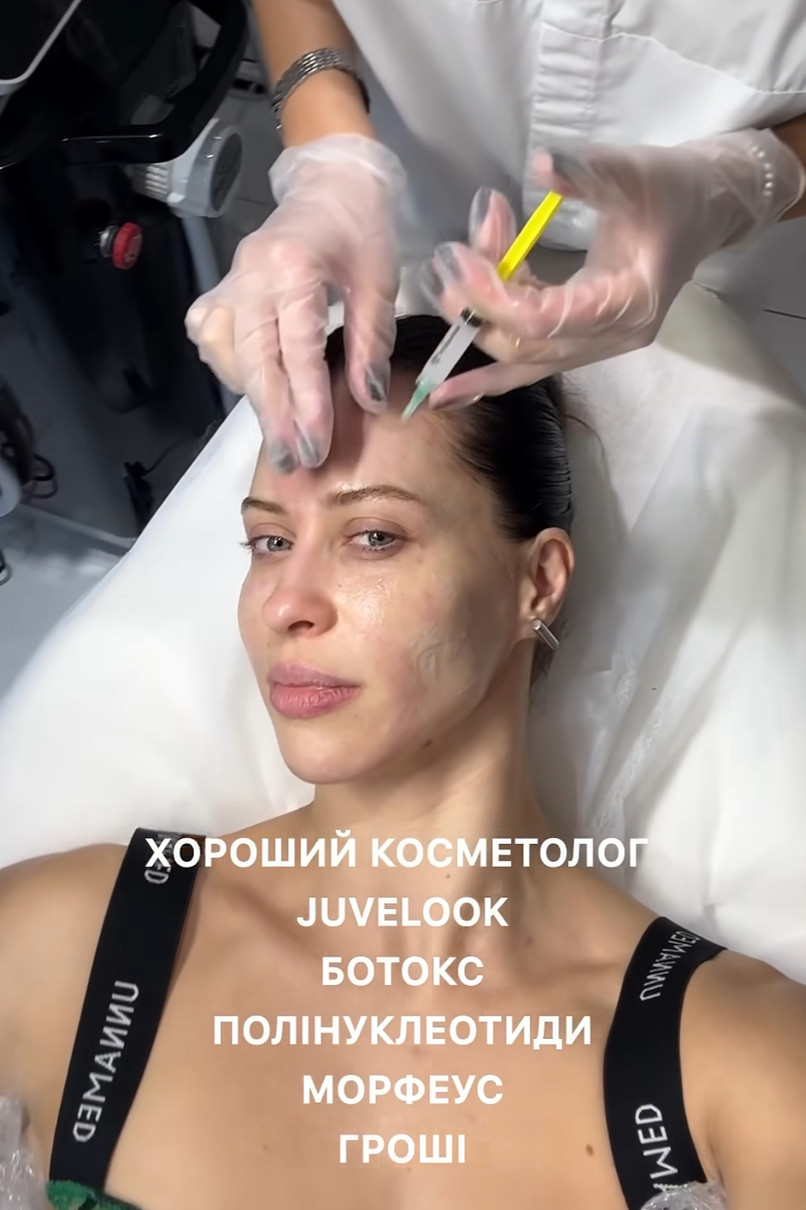 Вікторія Маремуха показала, як їй роблять укол в чоло