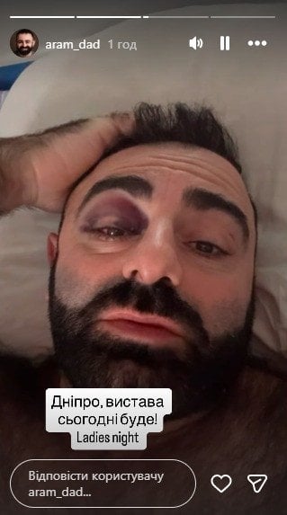 Арам Арзуманян у лікарні / © instagram.com/aram_dad