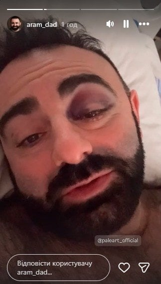 Арам Арзуманян у лікарні / © instagram.com/aram_dad