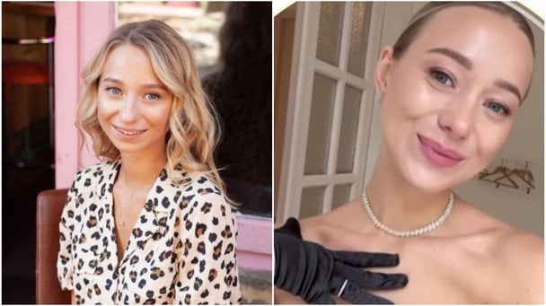 Катерина Реп’яхова до та після оперативних втручань / © instagram.com/repyahovakate