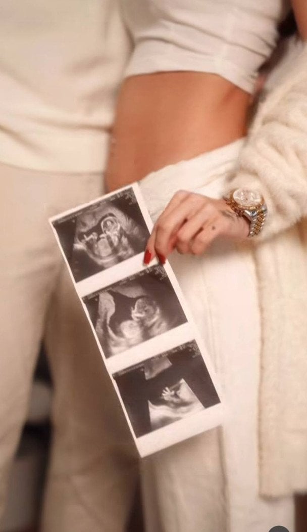 Ігор Пустовіт стане батьком втретє / © instagram.com/pustovit