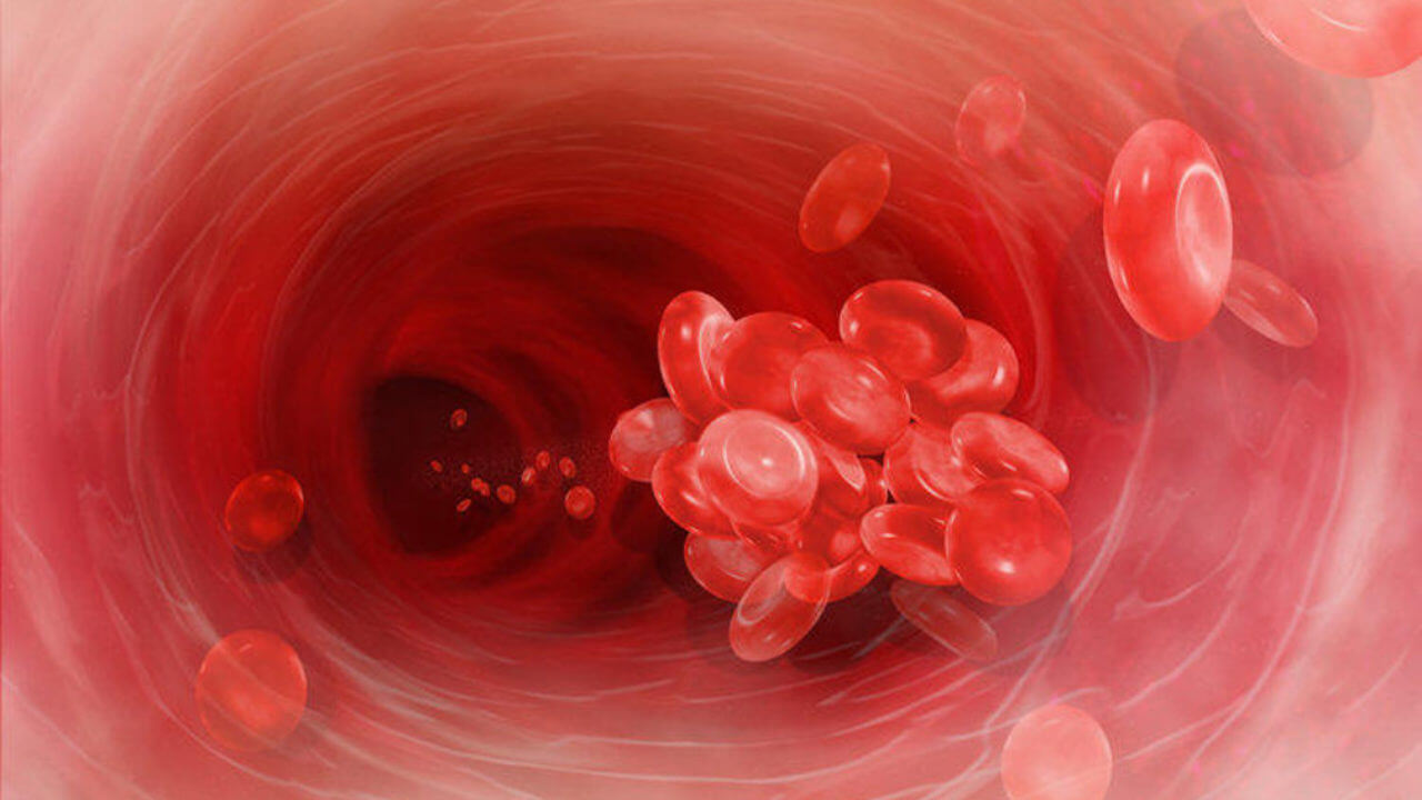 Онкологія: тромб часто є першою ознакою раку підшлункової залози Тромби