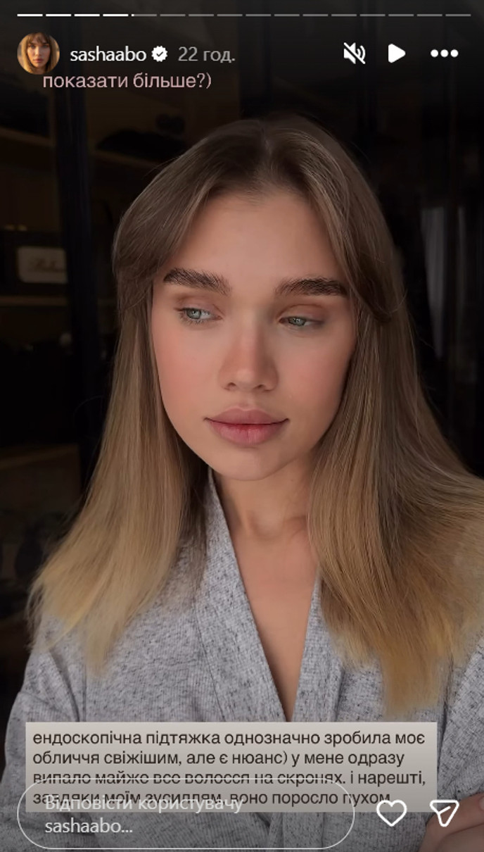 Саша Бо вразила наслідками пластичної операції