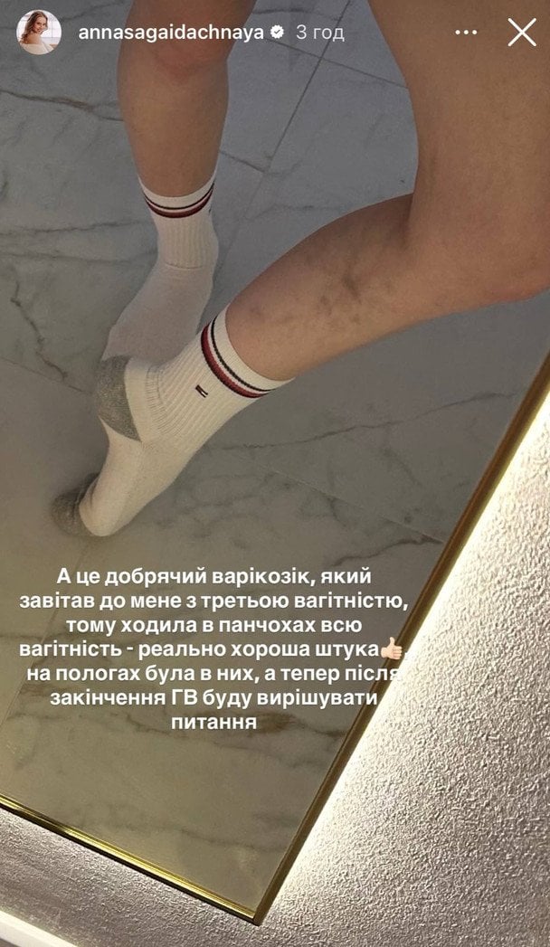 Анна Сагайдачна / © instagram.com/annasagaidachnaya