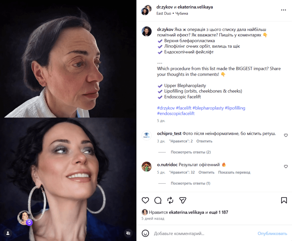 Зірка МастерШеф Катерина Велика назвала всі свої пластичні операції Фото: скриншот Інстаграм Катерини Великої