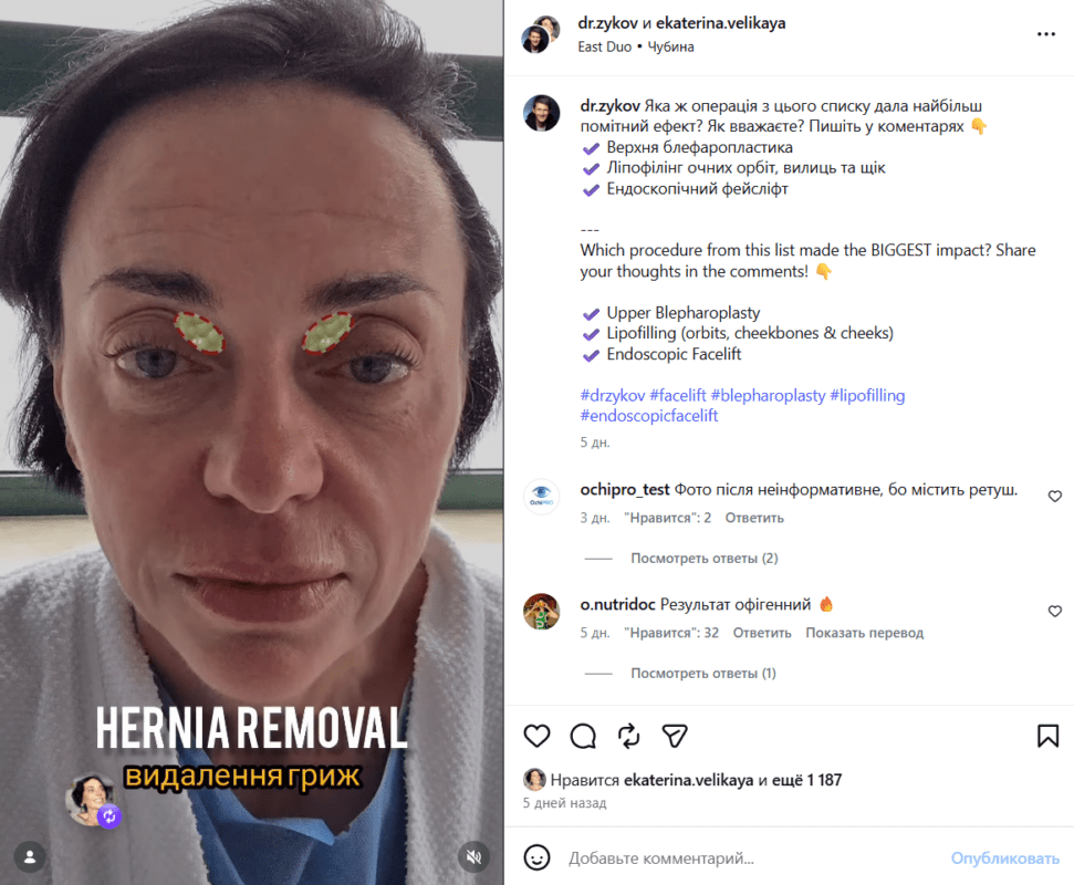 Причому в Інстаграмі Велика навіть оприлюднила відео, на якому було знято перші хвилини в операційній.