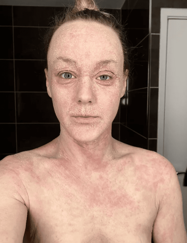 Бетані Норман / © BBC